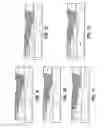 Fig. 07 - Shift and hold conveyor assembly for removal of oversize parcels