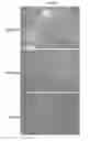Fig. 02 - Methods of differentiating stem cells into chondrocytes
