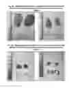Fig. 08 - Composition and methods for the prevention and treatment of diet-induced obesity