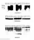 Fig. 07 - Transgenic Plants With RNA Interference-Mediated Resistance Against Root-Knot Nematodes