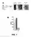 Fig. 02 - MOLECULAR SIGNATURE FOR AGGRESSIVE SQUAMOUS CELL CARCINOMAS OF THE HEAD AND NECK