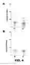 Fig. 07 - MOLECULAR SIGNATURE FOR AGGRESSIVE SQUAMOUS CELL CARCINOMAS OF THE HEAD AND NECK