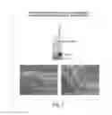 Fig. 10 - Genetic Lesion Associated With Cancer