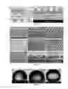 Fig. 12 - DROPLET-BASED MICROFLUIDIC DEVICE HAVING A PLURALITY OF REACTION SITES