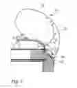 Fig. 06 - Tent and an awning assembly