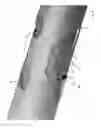 Fig. 06 - TUBING ANCHORING AND MOVEMENT REDUCING SYSTEM