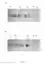 Fig. 06 - Microfluidic device for gel electrophoresis and method of manufacturing thereof