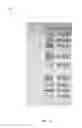 Fig. 09 - Microfluidic device for gel electrophoresis and method of manufacturing thereof
