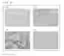Fig. 07 - Cancer marker and utilization thereof