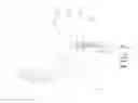 Fig. 03 - Connection device for connecting lens to frame
