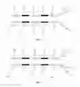 Fig. 03 - Liquid crystal panel having a plurality of first common electrodes and a plurality of first pixel electrodes alternately arranged on a lower substrate, and display device incorporating the same