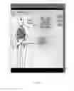Fig. 09 - Avatar-based charting method and system for assisted diagnosis