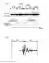 Fig. 07 - Noise reduction apparatus, noise reduction method, and noise reduction program