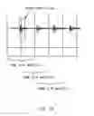 Fig. 09 - Noise reduction apparatus, noise reduction method, and noise reduction program