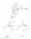 Fig. 02 - DEVICE FOR INSERTING OR WITHDRAWING A HEARING AID