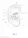 Fig. 06 - Personal hearing device