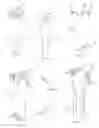 Fig. 09 - Shoe having convertible heel