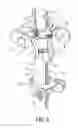 Fig. 09 - Foldable chair and cane, with a locking structure