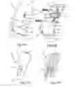 Fig. 18 - Control assembly for chair
