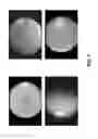 Fig. 02 - System and method for detecting and classifying severity of retinal disease