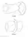 Fig. 04 - CATHETER IMAGING PROBE AND METHOD