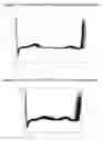 Fig. 07 - Non-invasive evaluation of cardiac repolarisation instability for risk stratification of sudden cardiac death