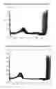Fig. 08 - Non-invasive evaluation of cardiac repolarisation instability for risk stratification of sudden cardiac death