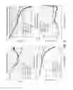 Fig. 06 - Systems, methods, and devices for characterizing ear canal acoustic impedance, admittance, and reflectance by pole-zero fitting