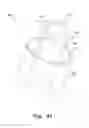 Fig. 35 - Medical material delivery device