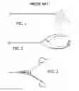 Fig. 02 - Crosstalk reducing handle for surgical articulated instruments
