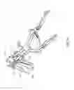 Fig. 22 - Surgical instrumentation and method