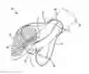 Fig. 01 - Endoscopic system for accessing constrained surgical spaces