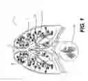 Fig. 02 - Devices and methods for lumen occlusion