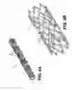 Fig. 06 - Devices and methods for lumen occlusion