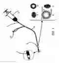 Fig. 02 - Method for dynamic regulations (counter pulsation) of the venous return to the heart for the treatment of patients with heart failure