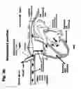 Fig. 06 - Method for dynamic regulations (counter pulsation) of the venous return to the heart for the treatment of patients with heart failure