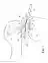 Fig. 04 - Anatomic femoral guide