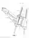 Fig. 10 - Anatomic femoral guide