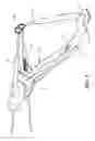Fig. 11 - Anatomic femoral guide