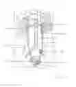 Fig. 02 - Calculus retrieving/removing device and method