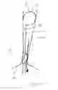 Fig. 09 - Calculus retrieving/removing device and method