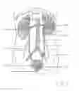 Fig. 02 - Calculus retrieving/removing device and method