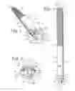 Fig. 02 - Orthopedic implant rod reduction tool set and method