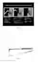 Fig. 02 - MICRO-MECHANICAL DEVICE AND METHOD FOR OBSTRUCTIVE SLEEP APNEA TREATMENT
