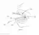 Fig. 07 - MICRO-MECHANICAL DEVICE AND METHOD FOR OBSTRUCTIVE SLEEP APNEA TREATMENT