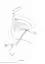 Fig. 09 - MICRO-MECHANICAL DEVICE AND METHOD FOR OBSTRUCTIVE SLEEP APNEA TREATMENT