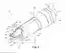 Fig. 03 - Electrosurgical cutting instrument