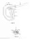 Fig. 06 - Double loop lasso with single puller wire for bi-directional actuation