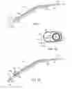 Fig. 02 - Illuminated suction apparatus