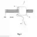 Fig. 03 - Automatic registration of the penetration depth and the rotational orientation of an invasive instrument